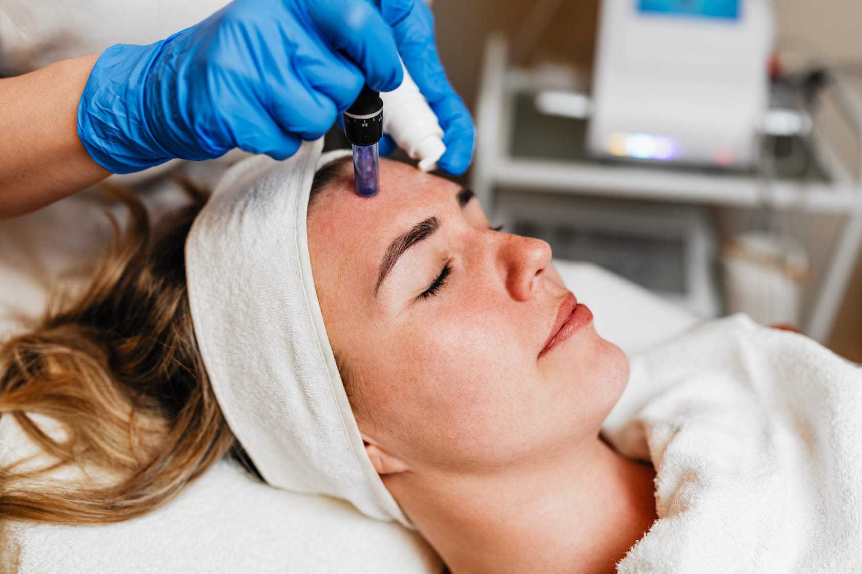 Holistic microneedling procedure in Fort Collins, CO at Masque by Mask Balanced Skincare.