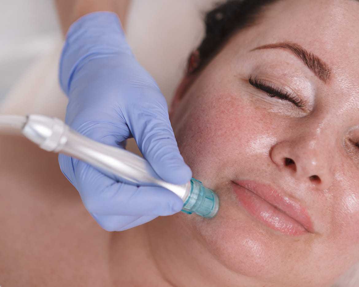 Facial treatment with a skin-cleansing tool on a woman's cheek by a gloved professional.